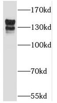 TRAPPC9 Rabbit Polyclonal Antibody