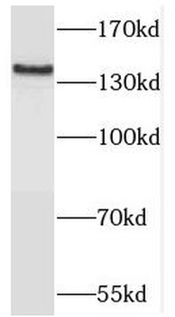 TRAPPC9 Rabbit Polyclonal Antibody