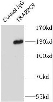 TRAPPC9 Rabbit Polyclonal Antibody