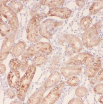 TRAPPC9 Rabbit Polyclonal Antibody