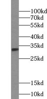 TREX1 Rabbit Polyclonal Antibody