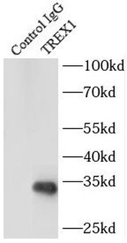 TREX1 Rabbit Polyclonal Antibody