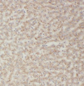 TRIM14 Rabbit Polyclonal Antibody