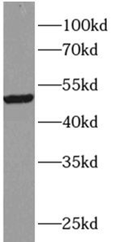 TRIM15 Rabbit Polyclonal Antibody