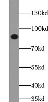 TRIM2 Rabbit Polyclonal Antibody