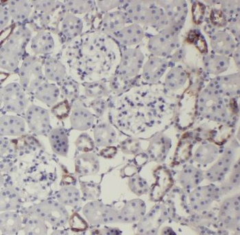 TRIM2 Rabbit Polyclonal Antibody