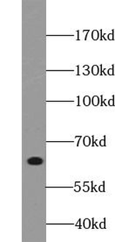 TRIM29 Rabbit Polyclonal Antibody