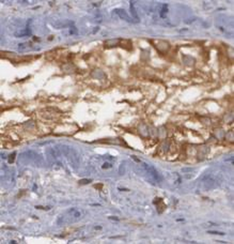 TRIM29 Rabbit Polyclonal Antibody