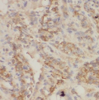 TRIM32 Rabbit Polyclonal Antibody