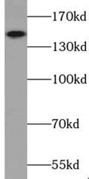 TRIM33 Rabbit Polyclonal Antibody