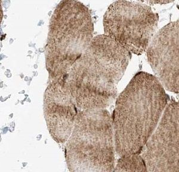 TRIM41 Rabbit Polyclonal Antibody