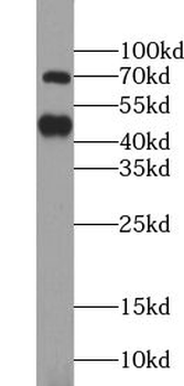 TRIM5 Rabbit Polyclonal Antibody