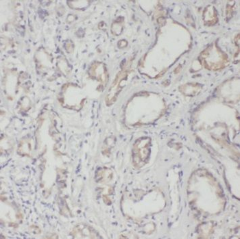 TRIM5 Rabbit Polyclonal Antibody