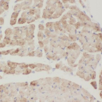 TRIM54 Rabbit Polyclonal Antibody