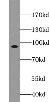 TRIM9 Rabbit Polyclonal Antibody