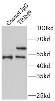 TRIM9 Rabbit Polyclonal Antibody