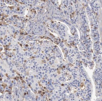 TRIM9 Rabbit Polyclonal Antibody