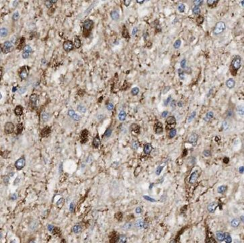 TFG Rabbit Polyclonal Antibody