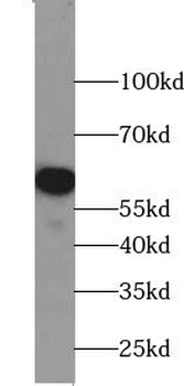 TRMT6 Antibody