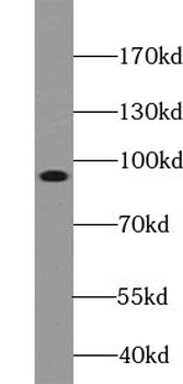 TRPC4AP Antibody