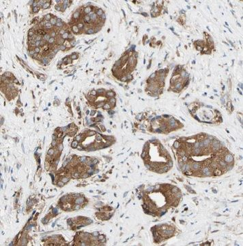TRPC4AP Antibody