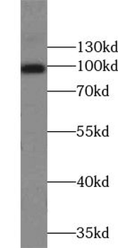 TRPC6 Rabbit Polyclonal Antibody