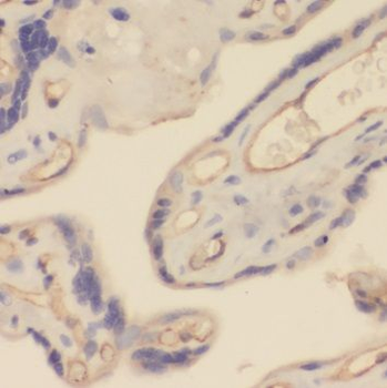 TRPC6 Rabbit Polyclonal Antibody