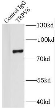 TRPV6 Antibody