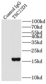 TSC22D1 Rabbit Polyclonal Antibody