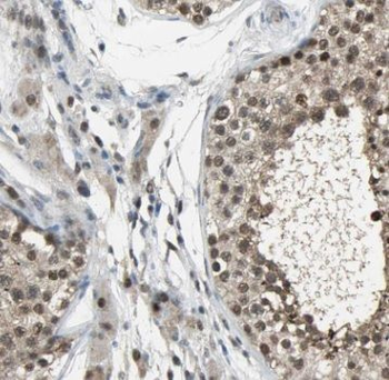 TSC22D1 Rabbit Polyclonal Antibody