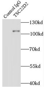 TSC22D2 Rabbit Polyclonal Antibody