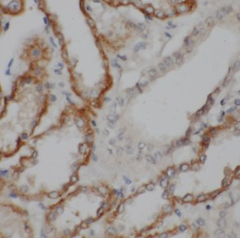 TSC22D2 Rabbit Polyclonal Antibody