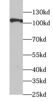 TSHR Antibody