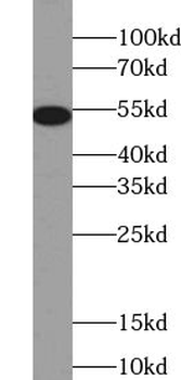 TSP50 Rabbit Polyclonal Antibody