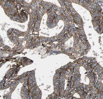 TSP50 Rabbit Polyclonal Antibody