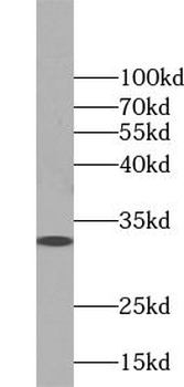 TSPAN13 Rabbit Polyclonal Antibody