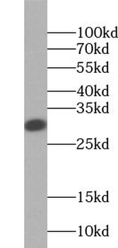 TSPAN6 Rabbit Polyclonal Antibody