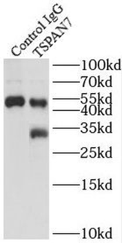 TSPAN7 Rabbit Polyclonal Antibody