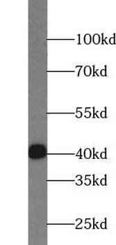 TSPY3 Rabbit Polyclonal Antibody