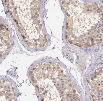 TSPY3 Rabbit Polyclonal Antibody