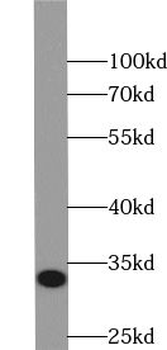 TST Antibody