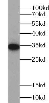 TTC1 Rabbit Polyclonal Antibody
