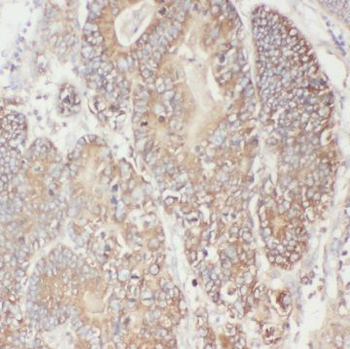 TTC1 Rabbit Polyclonal Antibody