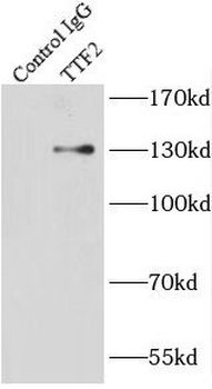 TTF2 Antibody