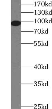 TTK Rabbit Polyclonal Antibody