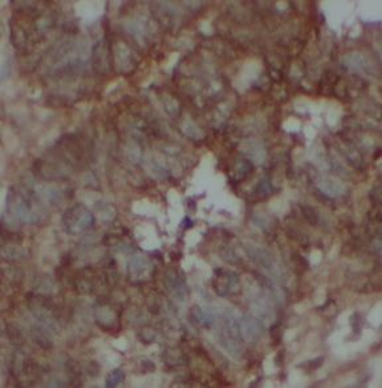 TTK Rabbit Polyclonal Antibody
