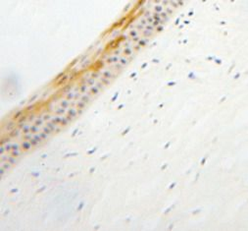 TULP1 Rabbit Polyclonal Antibody