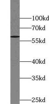 TULP3 Rabbit Polyclonal Antibody