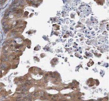 TULP3 Rabbit Polyclonal Antibody