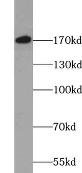 TULP4 Rabbit Polyclonal Antibody